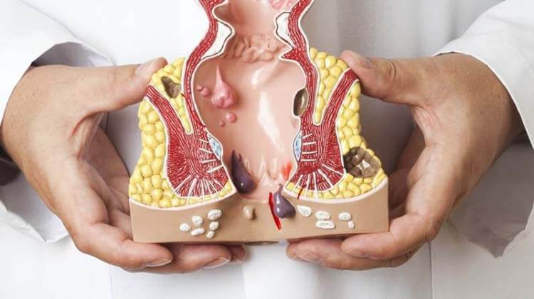 Jual Ambejos Salep Salwa Herbal Denature Di Musi Rawas